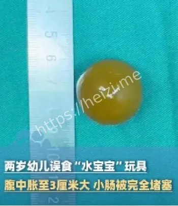2岁男童误食水宝宝